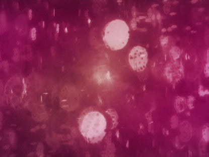 Streaked Bokeh Static Pink