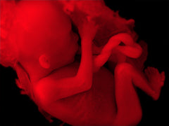 Sanctity Of Life