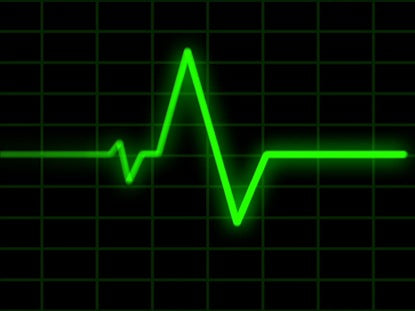 Heart Monitor