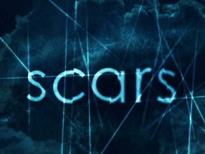 Scars