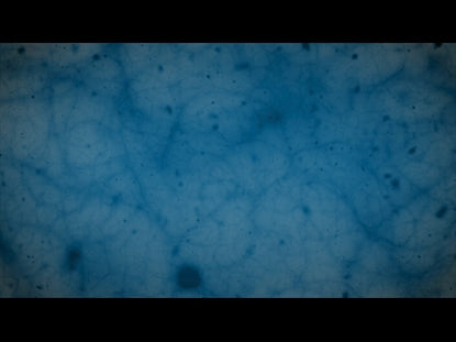 Coronavirus Update Teaching Motion 3